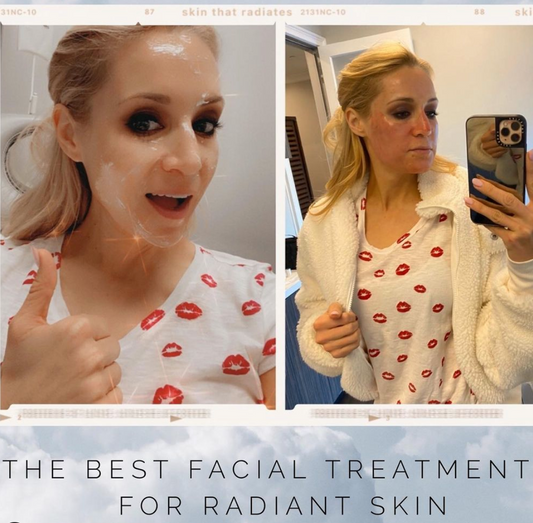 Episode 20: The best facial treatments for radiant skin!
